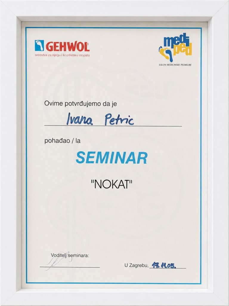 Njega noktiju